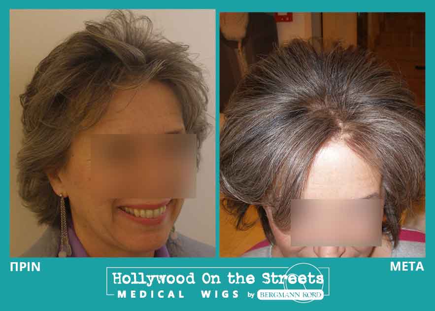 hair-system-hos-wigs-results-women-021112PG-002
