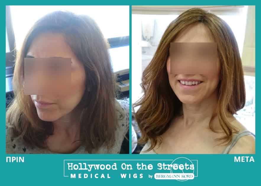 hair-system-hos-wigs-results-women-022298PG-001