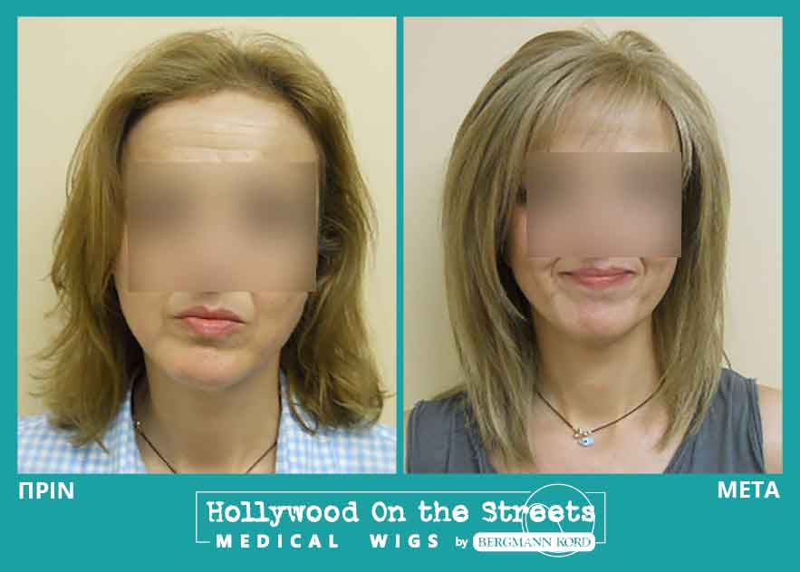 hair-system-hos-wigs-results-women-023114PG-001