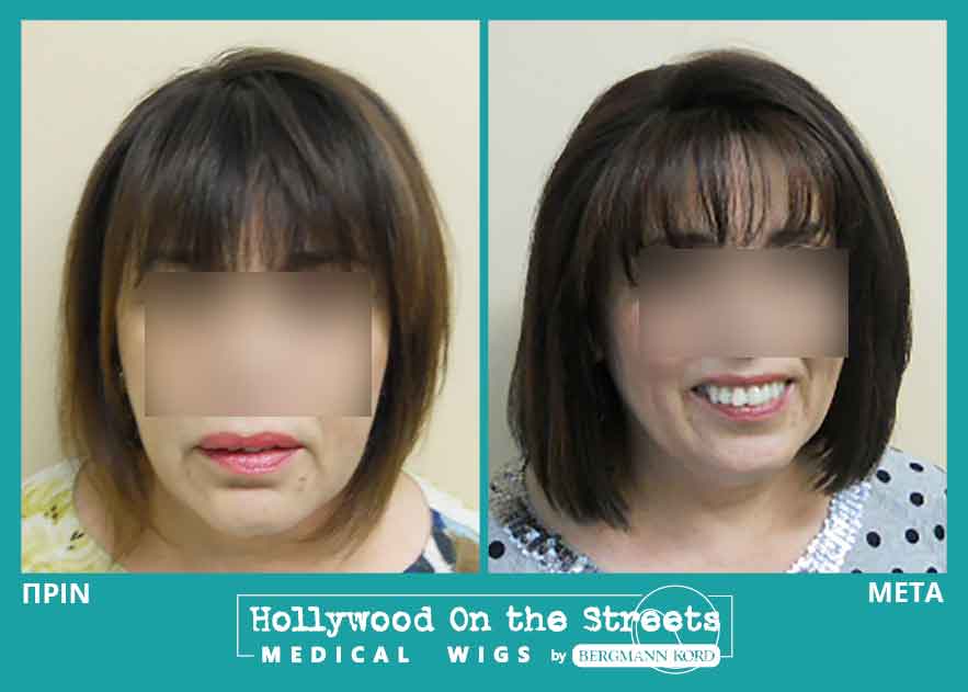 hair-system-hos-wigs-results-women-026359PG-001