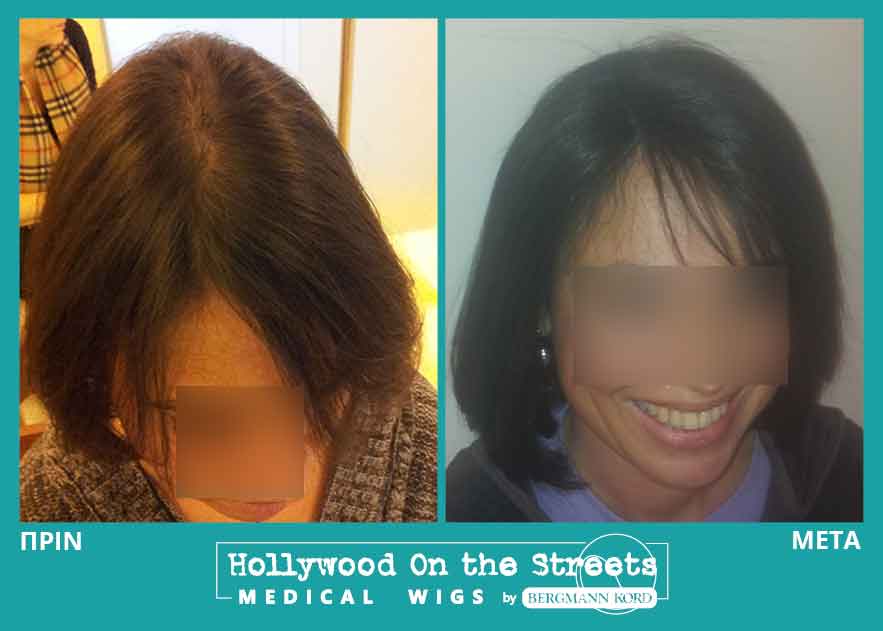 hair-system-hos-wigs-results-women-029814PG-001