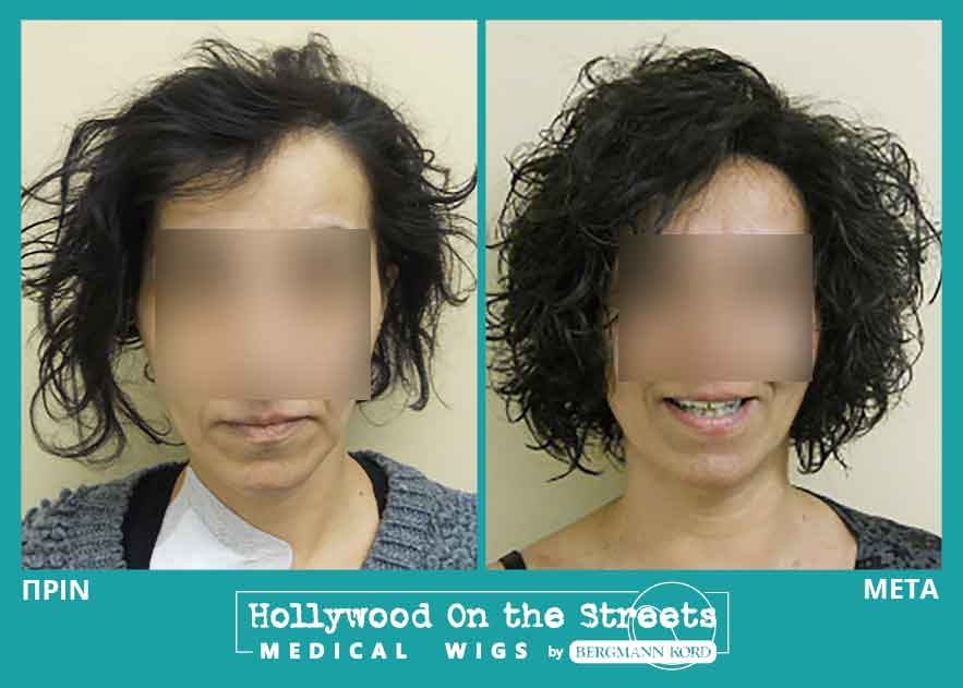 hair-system-hos-wigs-results-women-029816PG-001