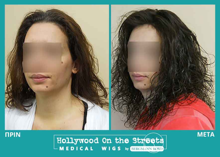 hair-system-hos-wigs-results-women-031558PG-001