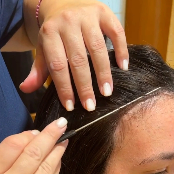 Εφαρμογή περούκας για χημειοθεραπεία