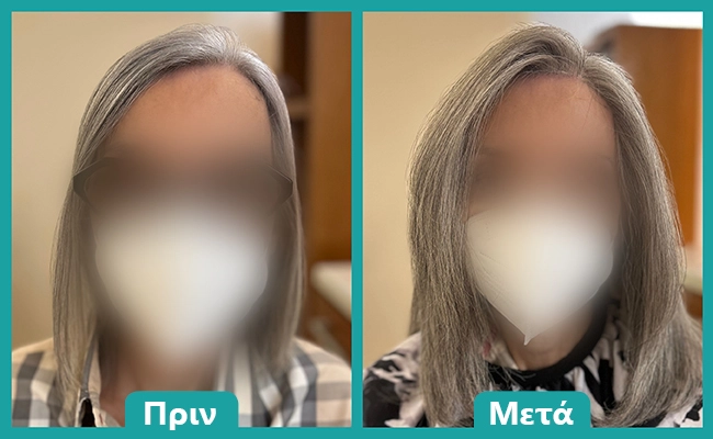 Περούκα με φυσικά μαλλιά