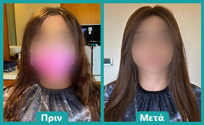 Φυσική περούκα αποτέλεσμα