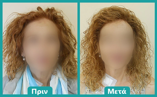 Αντιγραφή μαλλιών σε περούκα